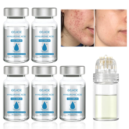 Gla-Mory Micro Infusion System for Lips,Micro Infusion Facial System,Gla-Mory Micro-Infusion Facial System,Repair Skin,Deep Nourishment,Suitable for All Skin Types (5 PCS Serum with Roller)