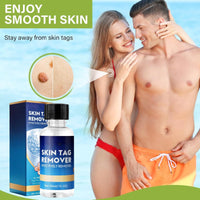 Yoowan Skin Ta/g Removal Serum,Fast-Acting & Painless Wa-Rt Remover,Wa-Rt Remover For Hands,Natural Plant Extract,Ta/g Dry&Fall Away Naturally Suitable For All Skin Types,Removal Of War-Ts On Back,Hands,Face