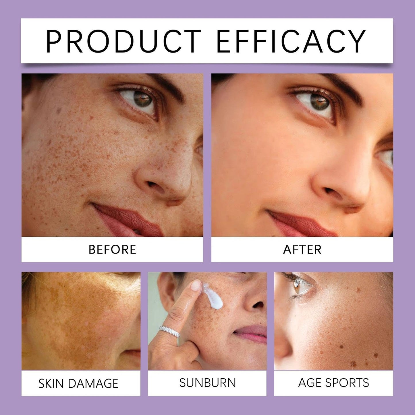 Wormeer Advanced Anti-Hyperpigmentation Cream - Skin Face Cream - Face Moisturisers, Improves Fine Lines, Even Out Skin-Tone, Suitable for All Skin Types - 20g