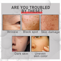 TONISABERY 100g Temporary Face Tightener,Skin Tightening Cream,Anti Wrinkle Face Cream for Mature Skin,Skin Tightening Cream for Face,Firming Face Cream for Loose Skin,Firm&Smooth the Look of Fine Lines