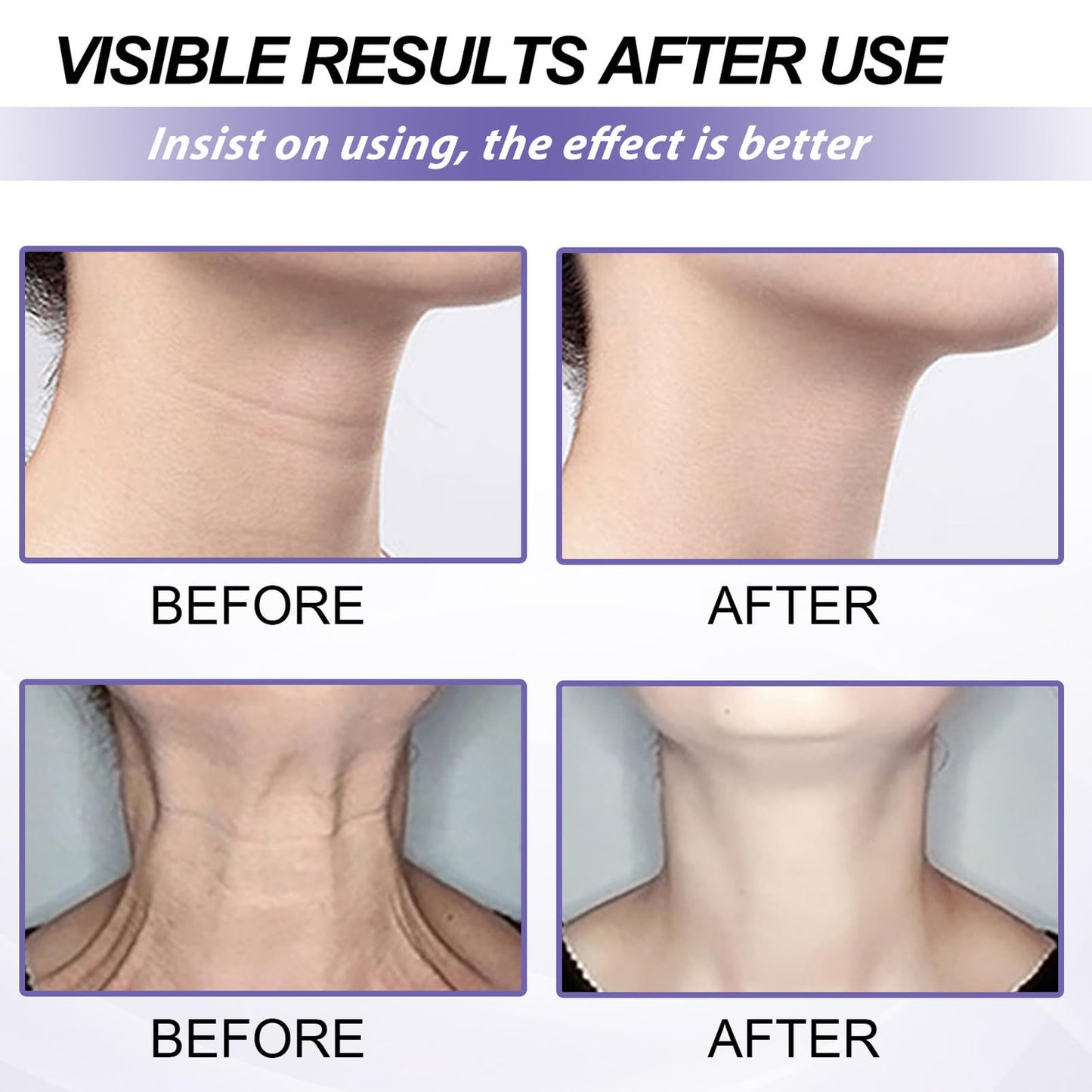 Tighten and Lift Neck Cream,Neck Firming Cream for Sagging Skin,Neck Tightening Cream with Collagen,Firming Cream for Loose Skin,Tighten & Lift Firming Neck Cream,Anti Aging Neck Cream-50ML