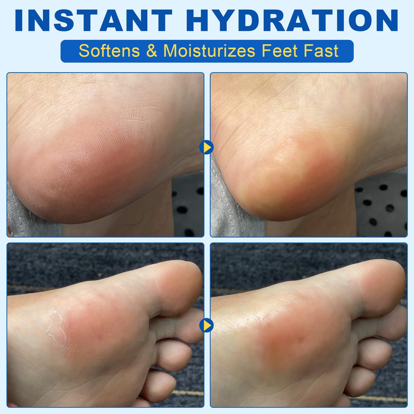 Generic Urea Foot Cream with Salicylic Acid – Heel Stick for Cracked Feet, Repairs Dry Rough Heels Fast, Intensive Moisturizer for Dead Skin, Hydrating Heel Balm with Urea for Smooth -Looking Feet