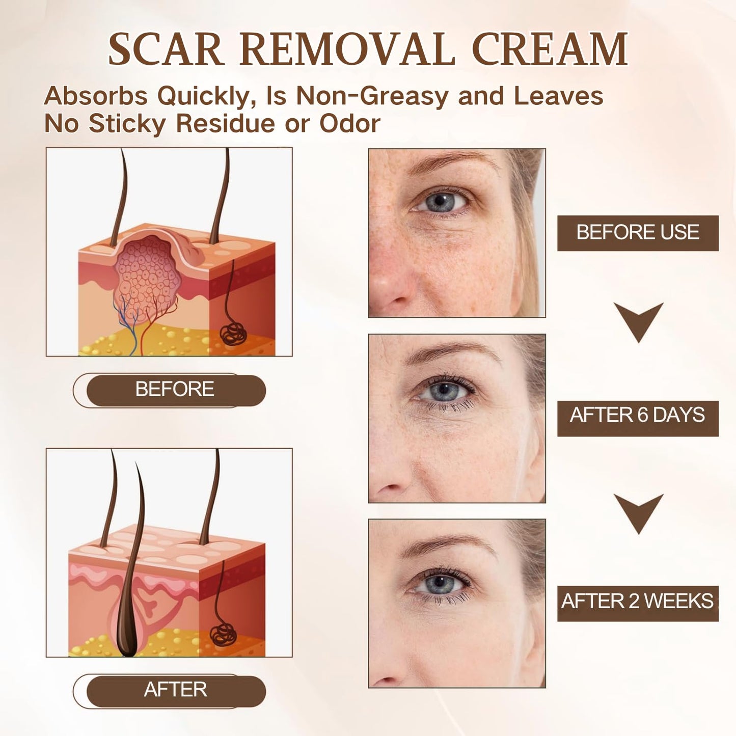 IZBEAUVO Dark Spot Corrector for Face &Body - Back Acne Removal Cream with 2% Salicylic Acid & Tea Tree Oil, Dark Spot Correcting Glow Serum Roller- Fades Pigmentation & Redness, Non-Comedogenic Moisturiser
