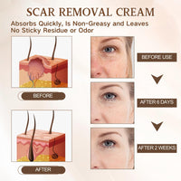 IZBEAUVO Dark Spot Corrector for Face &Body - Back Acne Removal Cream with 2% Salicylic Acid & Tea Tree Oil, Dark Spot Correcting Glow Serum Roller- Fades Pigmentation & Redness, Non-Comedogenic Moisturiser