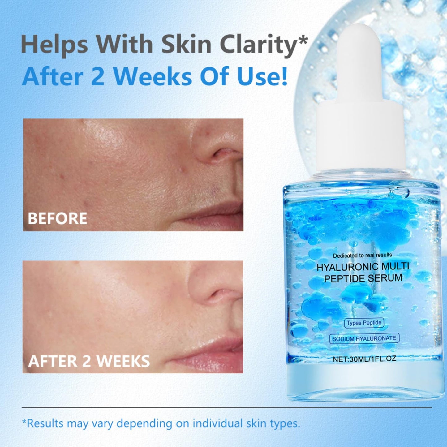 Tongyend Hyaluronic Multi Peptide Serum for Glowing and Soothing, PDRN Serum, Plumping Radiant Peptide Serums for Face, Hydrating Serums, Korean Skin Care, Anti-Aging Moisturiser,30ml