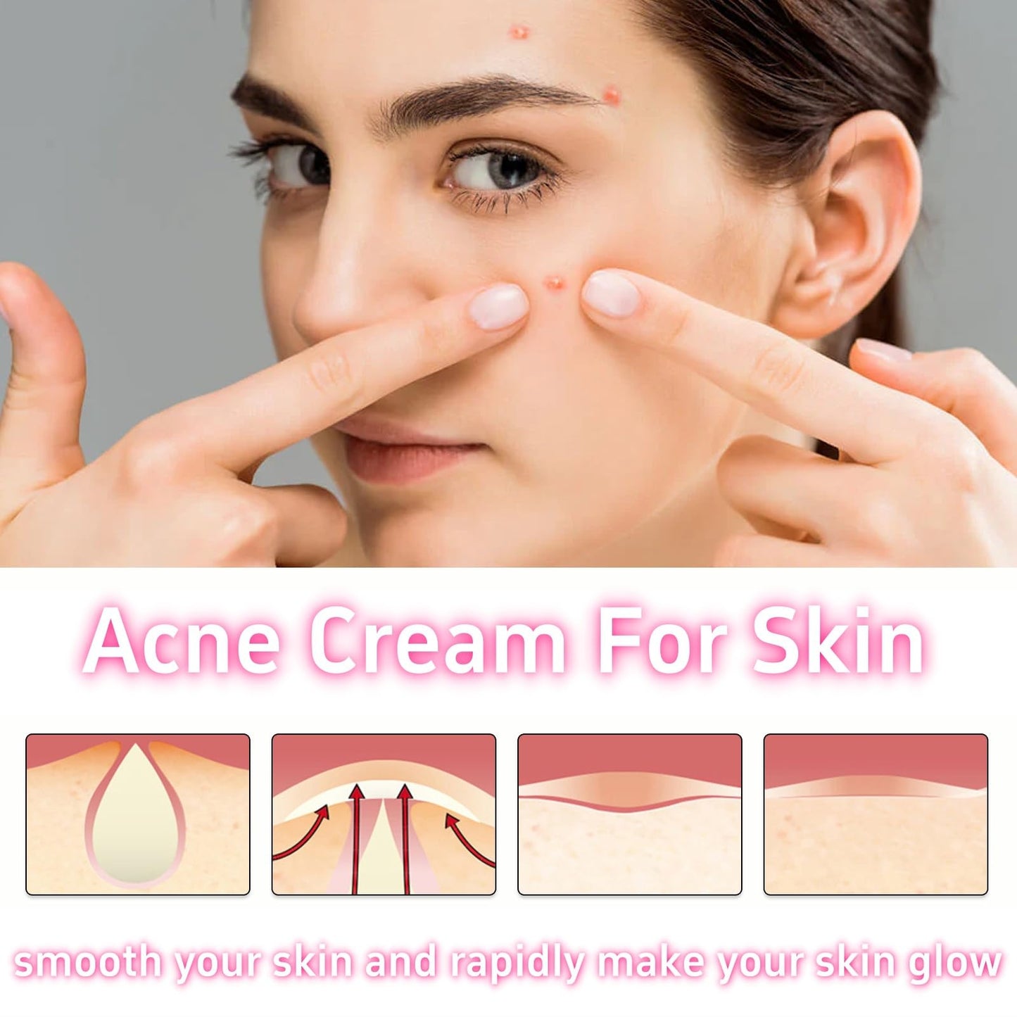 Xunzhi Acne Cream Pimple Cream for Face,Acne Treatment,Oil Control Pimple Remover Cr/eam,S/p/o/t Treatment,S/p/ot Crea/m,Acn/e Scar Treatm/ent,Anti Redness Crea/m for Face,Pim/ple Cre/am S/p/o/t Treatm/ent