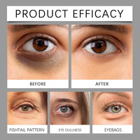 Siyinzu Cooling Eye Repair Stick for Men,Under Eye Cream for Dark Circles,Puffiness and Wrinkles,Hydrating Eye Bag Remover with Peptides and Vitamin C,Portable Eye Roller for Tired Eyes