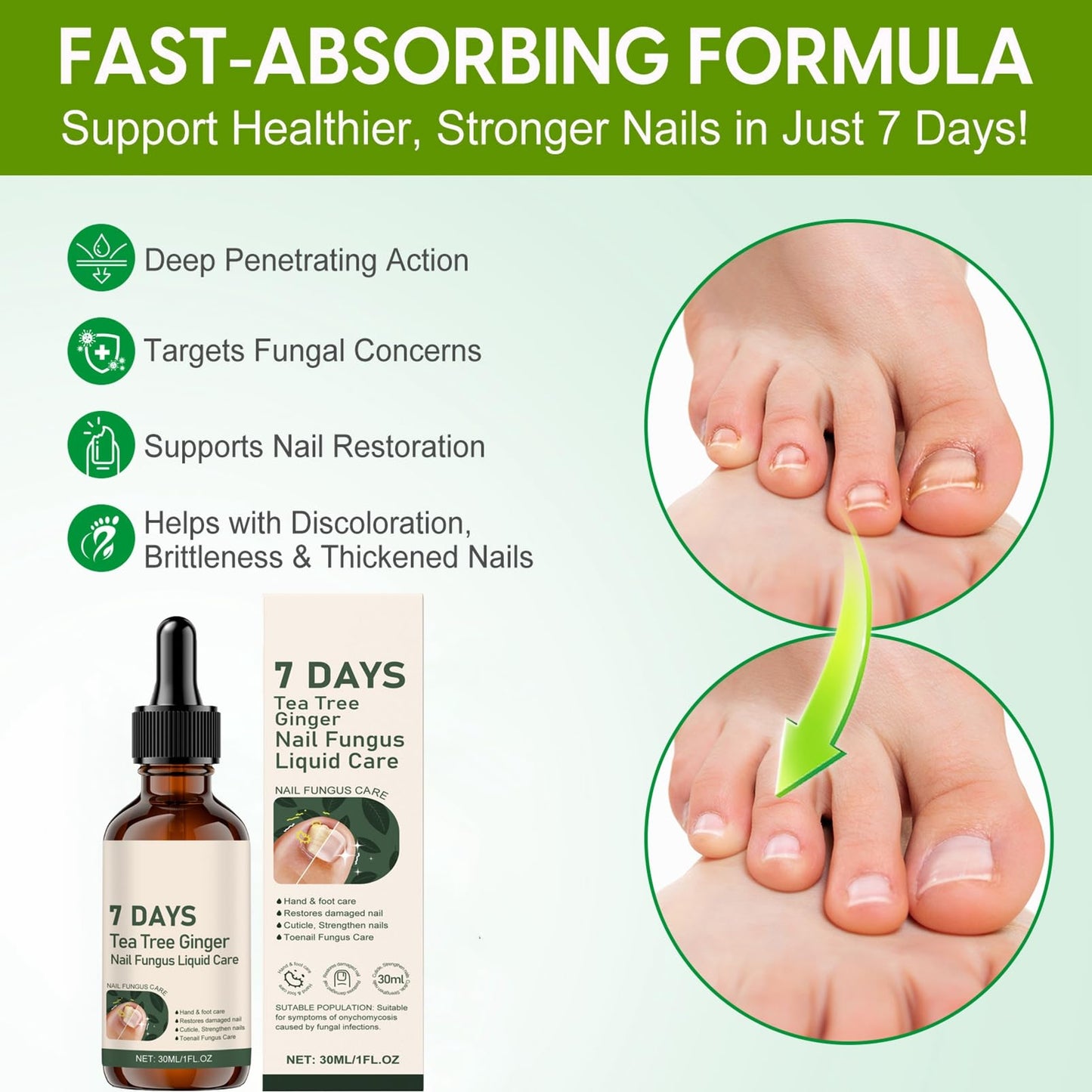 Tea Tree and Ginger Nail Fungus Treatment, Tea Tree Oil for Nail Fungus, 7 Days Fungal Nail Treatment for Toenail, Cuticle Care Oil, Nail Strengthener for Damaged Nails, Ginger Nail Serum