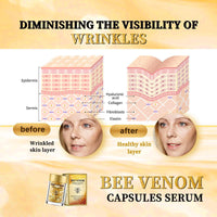 IZBEAUVO Bee Venom Firming & Renewal Capsule, Bee Venom Firming Serum, Anti Aging Serum for Women, Day and Night Serum Capsules, Natural Vegan Formula for Wrinkles, Sagging Skin & Stretch Marks
