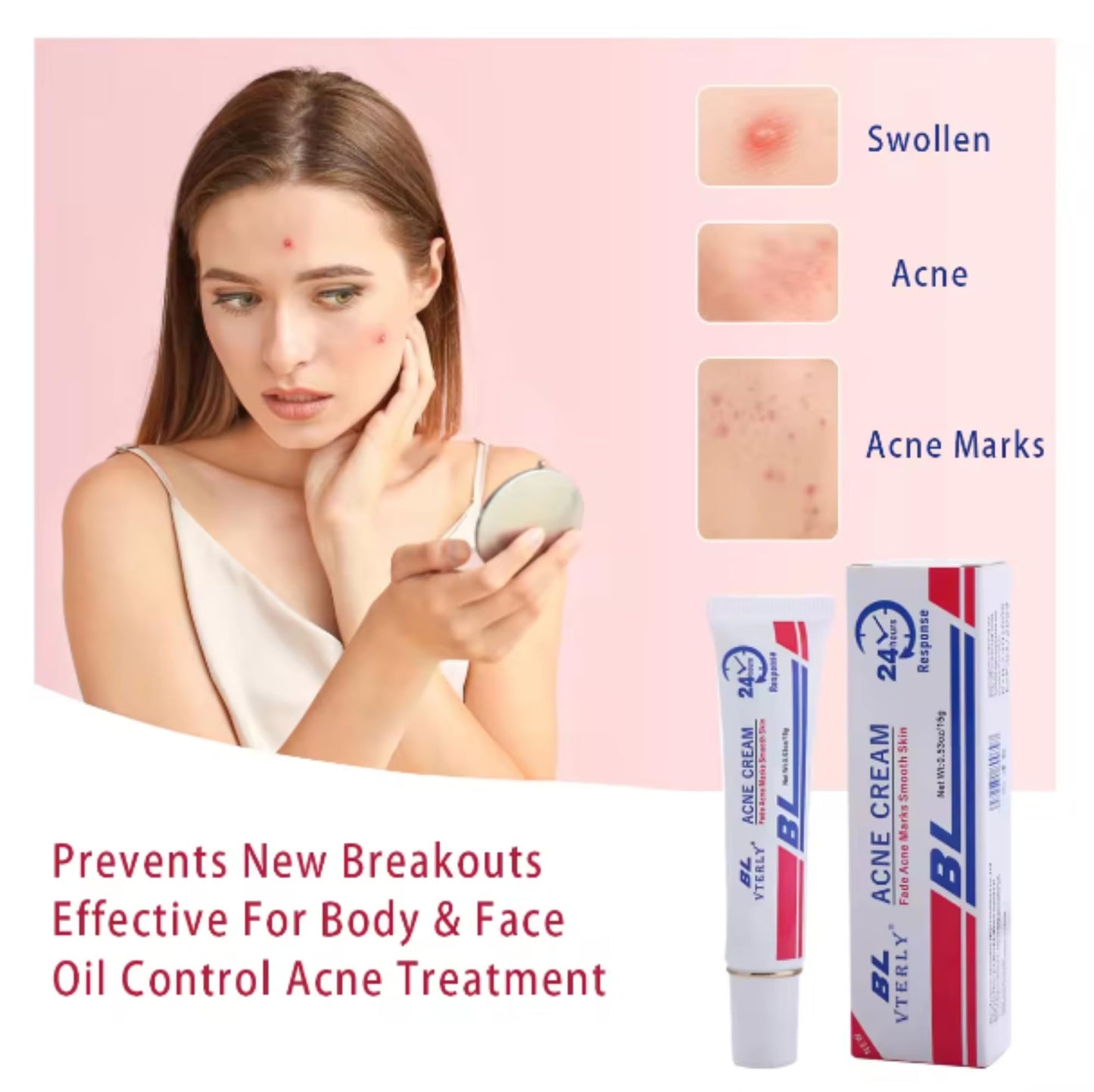 Rapid Acne Scar Treatment Cream - 24-Hour Fast Spot Reduction, Anti Acne Formula, Sensitive Skin Safe, Includes Fast Acne Scar Removal, Moisturiser, Deep Pore Cleansing - 30ml