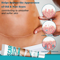 AuraBeen Scar Cream for Face & Body - Assists in Enhancing The Look of Stretch Marks, C - Section Scars, Surgical Scars - Suited for Old & New Scars - Facilitates Skin Restoration