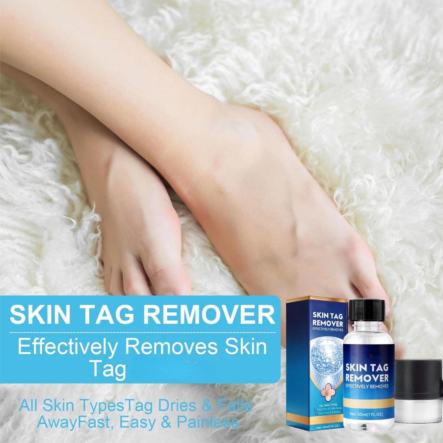 Yoowan Skin Ta/g Removal Serum,Fast-Acting & Painless Wa-Rt Remover,Wa-Rt Remover For Hands,Natural Plant Extract,Ta/g Dry&Fall Away Naturally Suitable For All Skin Types,Removal Of War-Ts On Back,Hands,Face