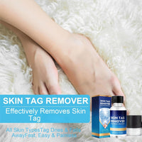 Yoowan Skin Ta/g Removal Serum,Fast-Acting & Painless Wa-Rt Remover,Wa-Rt Remover For Hands,Natural Plant Extract,Ta/g Dry&Fall Away Naturally Suitable For All Skin Types,Removal Of War-Ts On Back,Hands,Face