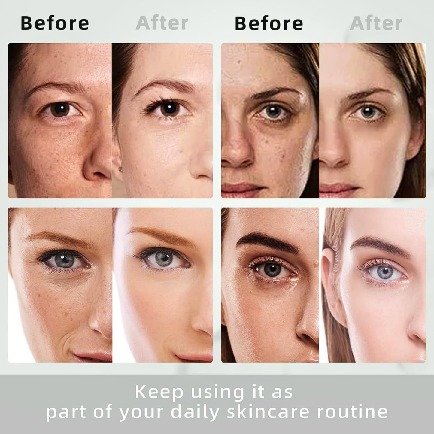 IZBEAUVO Dark Spot Remover For Face With Roller, Dark Spot Correcting Serum, Dark Spot Corrector For Age Spot Sun Spot Freckles Brown Spot, Melasma Treatment For Face, Hydrating Serum, Glow Serum