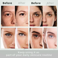 IZBEAUVO Dark Spot Remover For Face With Roller, Dark Spot Correcting Serum, Dark Spot Corrector For Age Spot Sun Spot Freckles Brown Spot, Melasma Treatment For Face, Hydrating Serum, Glow Serum