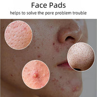 Ruojiar 70 Pads Red SUCC/inic Acid Panthe/NOL Face Exfoliator Pads,Exfoliating Toner Pa/ds for Acne Prone Skin,Zero Pore Pa/ds,for Exfoliation and Minimizing Po/res,Deep Clean Pores,Face Scrub Exfoliator