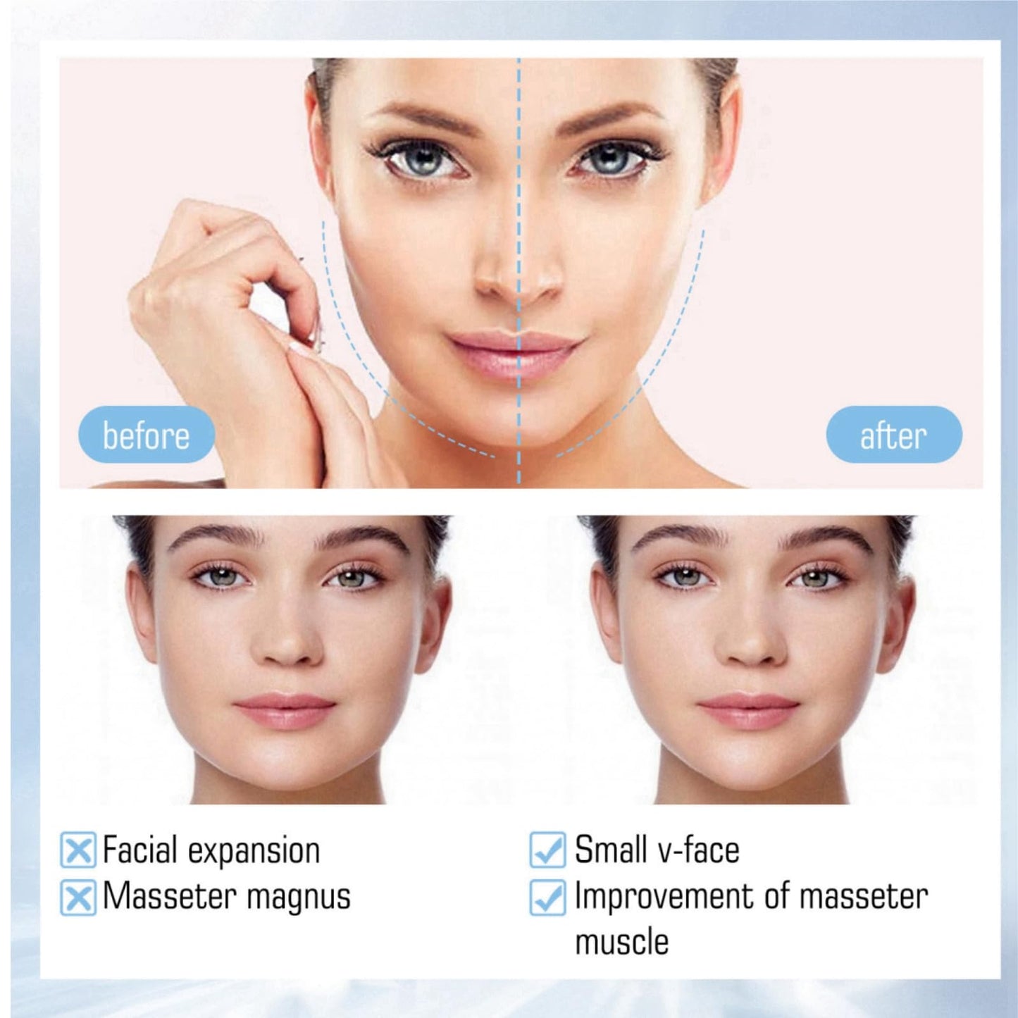Xinyig 5pcs Bloskin Lift Mask,Double Chin Mask,Face Lift Mask,Double-Chin Reducer Collagen Mask,Face Lifting Mask,V Line Lifting Mask,V Shape Face Tape Mask,V Lifting Chin Up Patch,Skin Tightening Mask