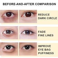 Ruojiar 2PCS Snail Peptide Energetic Eye Roll,Dark Circles Under Eye Treatment Women,Hydrating Snail Peptide Eye Cream,Eye Cream Anti-Aging,Under Eye Cream for Dark Circles and Puffy Eyes,Firming Eye Cream