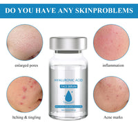 MADGININE Micro Infusion Facial System,Micro Infusion Kit,Beauty Micro Infusion Micro Infusion System Hyaluronic Acid Serum for Face Suitable for All Skin Types (3*Serum+Roller)