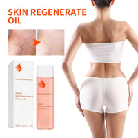 Oumun 125ml Optimal Oil,Stretch Mark & Scar Treatment Skincare Oil,Body Oil Skin Care,Skin Regenerate Oil,Collagen Boost Firming & Lifting Skincare Oil,Body Oil for Women,Stretch Marks Removal,Facial Oil