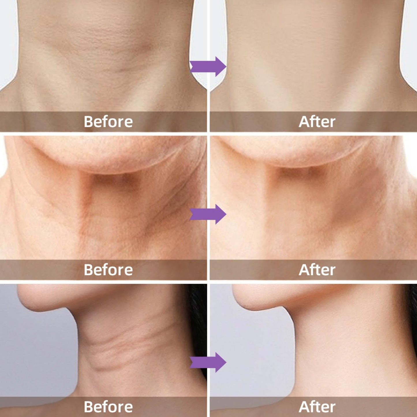 Neck Firming Cream with 5% Collagen Complex Tightening Lifting Sagging Skin Rejuvenating Moisturising Reducing Fine Lines Double Chin Reducer Cream 50ml