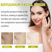 QinZiEn Retinol Revive Eye Cream,Anti Wrinkle Retinol Serum for Face,Anti Aging Retin-ol Cream for Neck,Dark Circles Under Eye Reti-nol Eye Cream,Face Serum Eye Bags Remover,Wrinkle Filler,F-ace Moisturisers