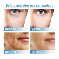 60 Pcs Forehead Wrinkle Patches,Anti Wrinkle Patches with Hyaluronic Acid,Face Tapes for Lifting Sagging Skin,Frownies Facial Patches,Face Lift Tape Invisible,Moisturizing & Tighten,Reduces Fine Lines