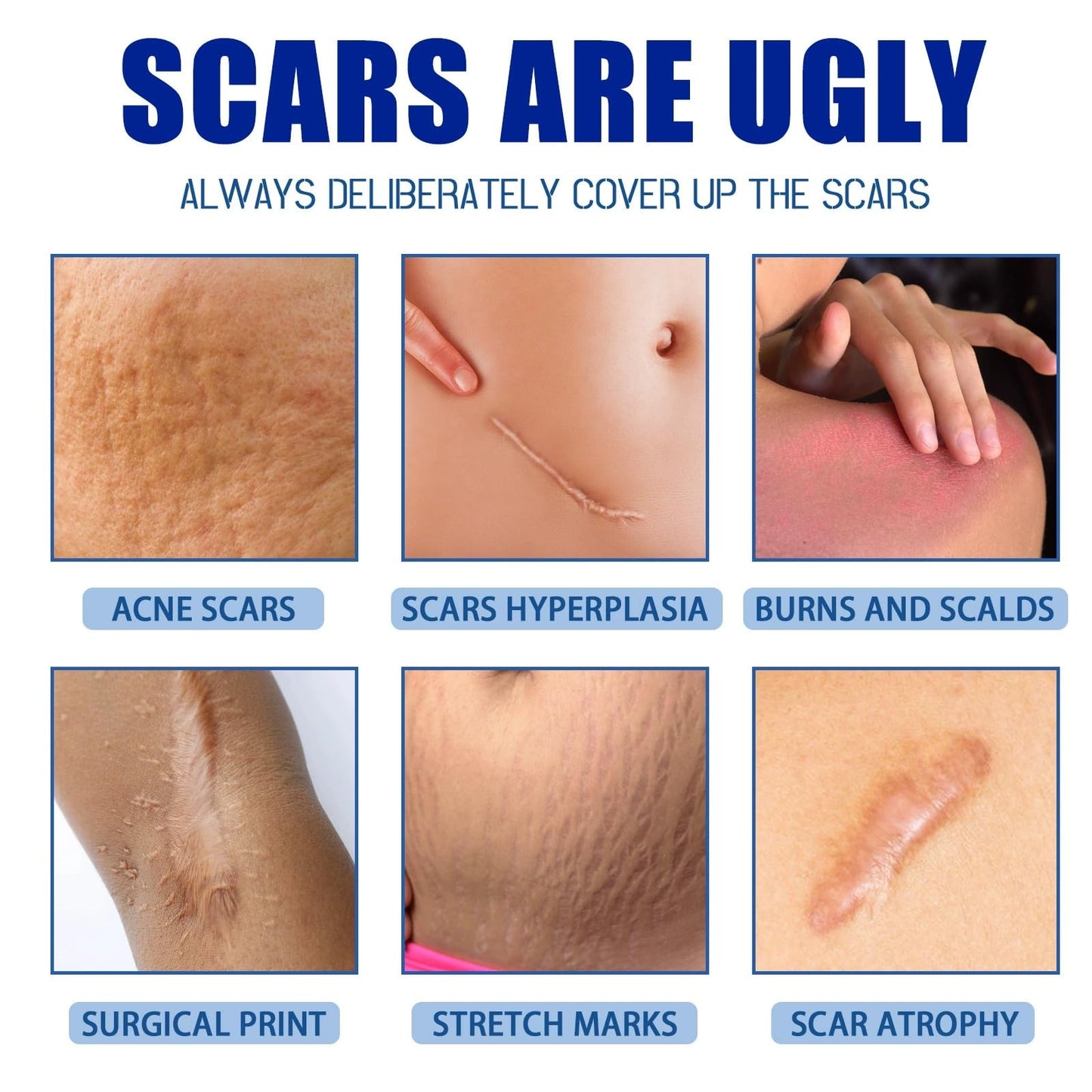 Jinjiar Scar Removal Set with Repair Scar Cream & Serum,Scar Removal Cream,Scar Treatment,Advanced Scar Gel for Old and New Scars,Scar Crea-m After Surgery,S-car Healing Cre-am,Acne Sc-ar Treatment,Scar Away