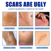 Jinjiar Scar Removal Set with Repair Scar Cream & Serum,Scar Removal Cream,Scar Treatment,Advanced Scar Gel for Old and New Scars,Scar Crea-m After Surgery,S-car Healing Cre-am,Acne Sc-ar Treatment,Scar Away