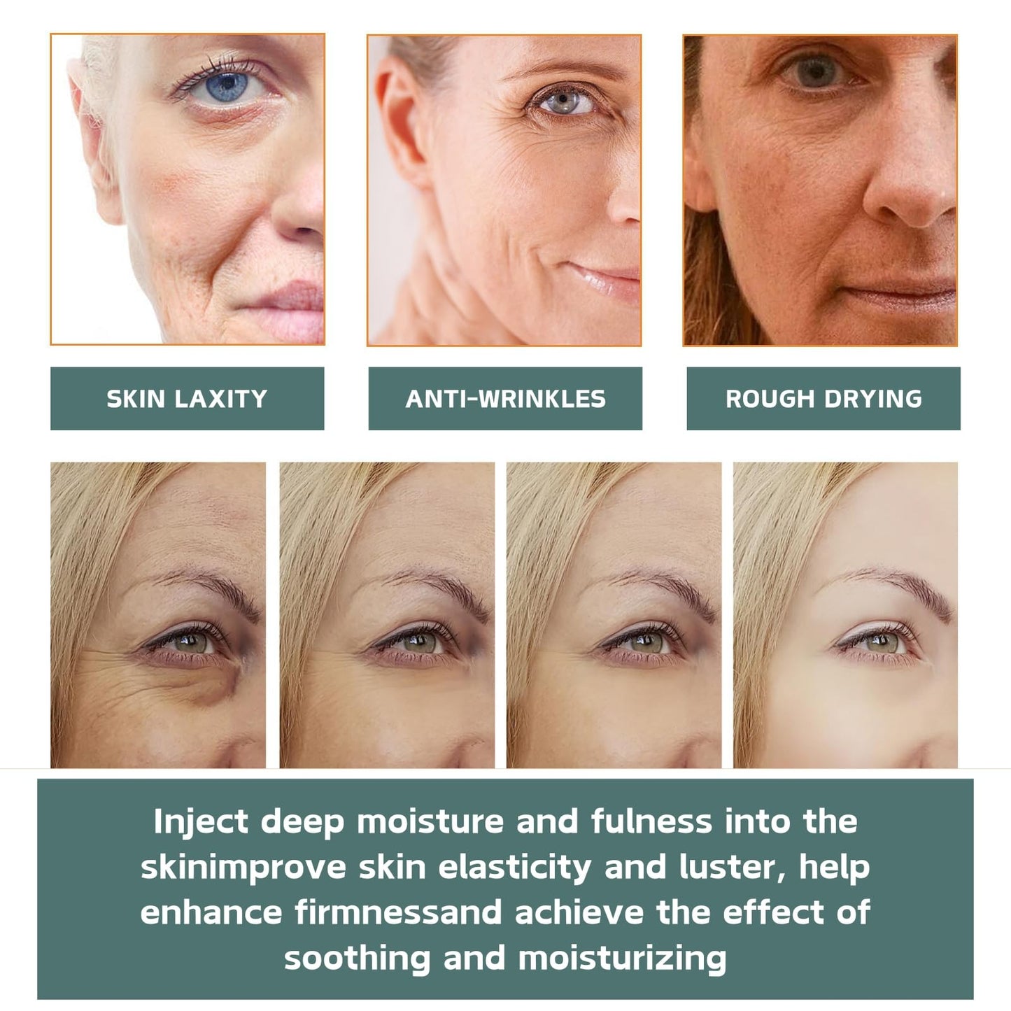 Cureluxe Pack of 5 Dissolving Microneedle Eye Patches,Dissolving Microneedle Eye Patches with Peptides,Hyaluronic acid,Glycerin,Anti Wrinkle Pat-ches,Under Eye Pat-ches for Dark Circles & Puffy Eyes