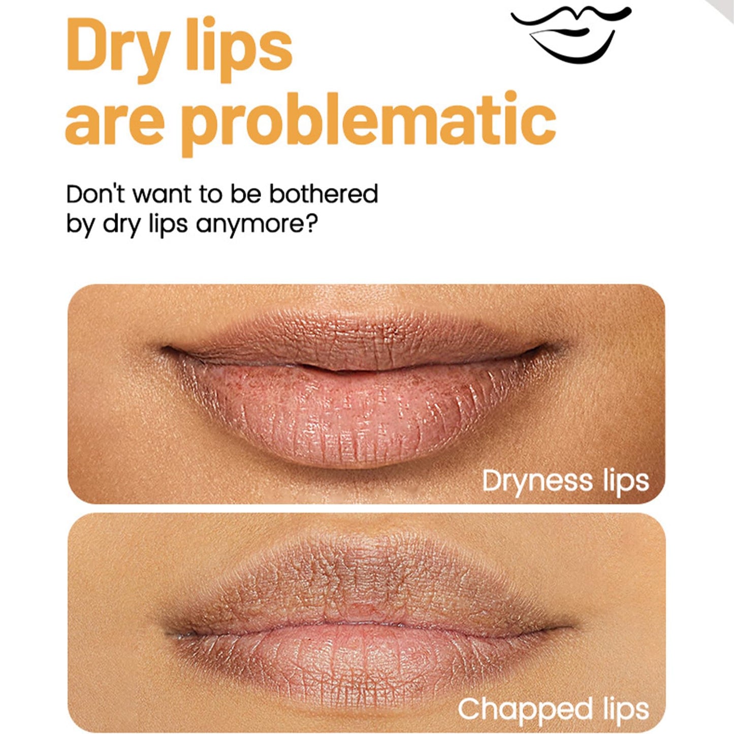 SHEBEEDO Lip Balm Set, Flavoured Lip Balms with Vitamin E and Honey, Moisturising Lip Balm Multipack, Protect & Hydrate Beewax Lip Balm Stick, Lip Moisturiser, Lip Gloss Sets for Teenage Girls