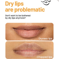 SHEBEEDO Lip Balm Set, Flavoured Lip Balms with Vitamin E and Honey, Moisturising Lip Balm Multipack, Protect & Hydrate Beewax Lip Balm Stick, Lip Moisturiser, Lip Gloss Sets for Teenage Girls