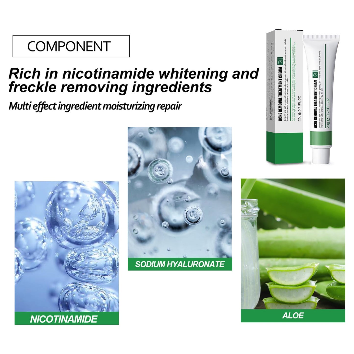 Anti Acne Face Cream, Spot Cream for Acne Treatment and Spot Treatment with Nicotinamide, Sodium Hyaluronate, Aloe, for Blackheads and Acne Prone Skin, Reduces Spot Size, Redness and Inflammation