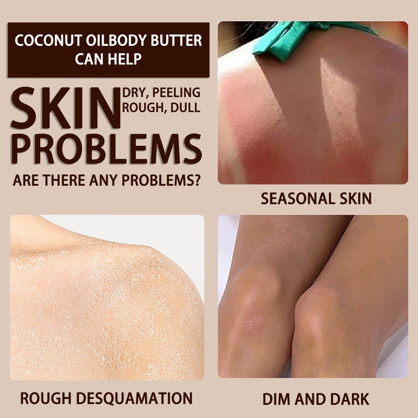 NatrLuxe 200g Coconut Body Butter - Body Cream For Women - Hydrating Lotion For Dry Skin - Moisturizer With Coconut Oil - Smooth, Improve Skin Texture