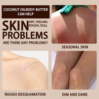 NatrLuxe 200g Coconut Body Butter - Body Cream For Women - Hydrating Lotion For Dry Skin - Moisturizer With Coconut Oil - Smooth, Improve Skin Texture