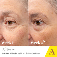 Absolute Collagen Deep Lift Eye Cream 15ml - Radiance Boosting - De-Puff and Brighten Dark Circles - Reduce Appearance of Fine Lines & Wrinkles - Collagen Boosting Anti-Ageing Formula - Firm & Tighten