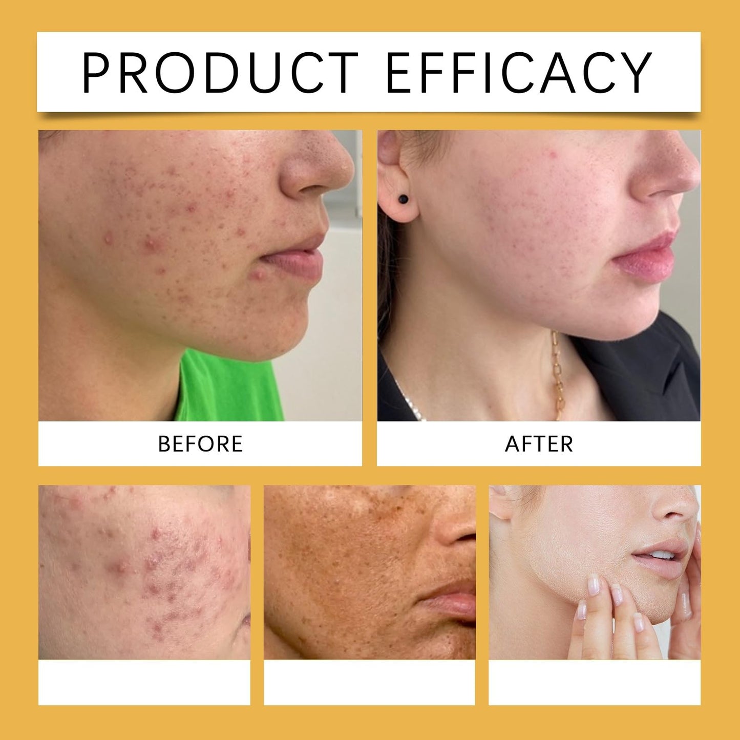 OuXing Spot Cream,Spot Treatment,Spot Remover,Spot Treatment for Face,Cream for Dark Skin Treatment,Anti Aging Face Cream,Spot Remover for Face,Freckle Removal Cream,Spot Corrector,Age Spot Remover for Face