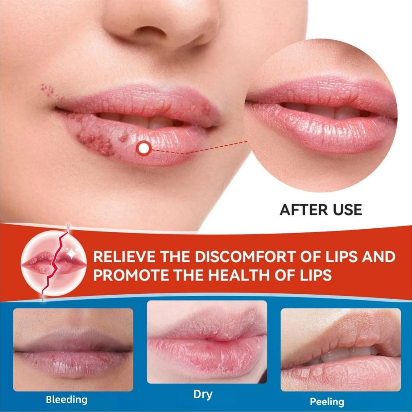 Cold Sore Cream,Cold Sore Treatment Cream,Mouth Ulcer Treatment for Adults,Gentle Sore Lips Treatment,Mouth Sore Treatment for Lips,Mouth Ulcer Gel,Fresh and Non-irritating,Natural Ingredients,20g
