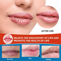 Cold Sore Cream,Cold Sore Treatment Cream,Mouth Ulcer Treatment for Adults,Gentle Sore Lips Treatment,Mouth Sore Treatment for Lips,Mouth Ulcer Gel,Fresh and Non-irritating,Natural Ingredients,20g