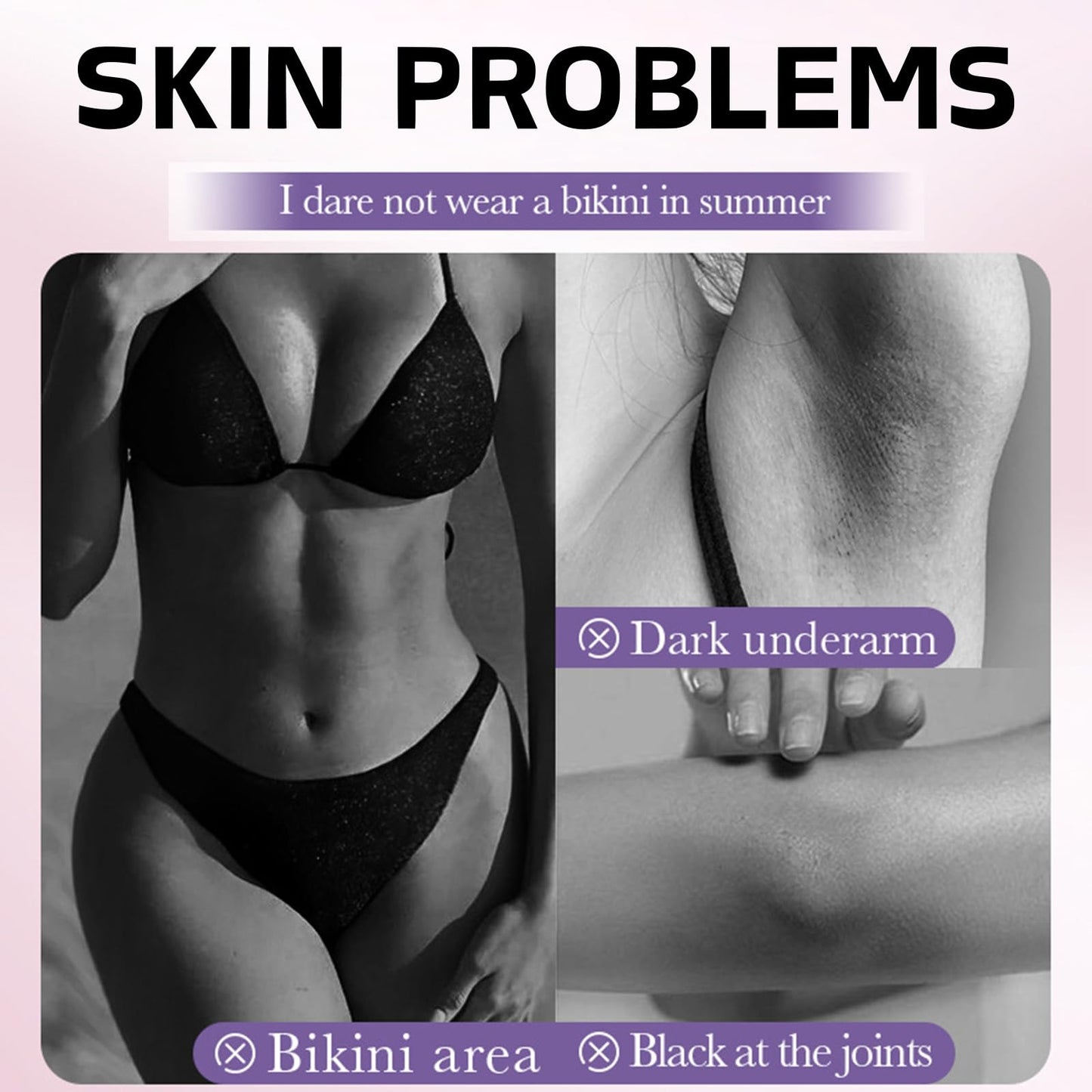 Snow Bleach Skin Whitening Cream - Dark Skin Whitening Cream for Women - Skin Lightening Cream for Dark Skin - Skin Bleaching Cream with Niacinamide,Arbutin,Vitamin C - Skin Bleach for Private,Leg,Arm