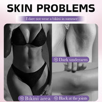 Snow Bleach Skin Whitening Cream - Dark Skin Whitening Cream for Women - Skin Lightening Cream for Dark Skin - Skin Bleaching Cream with Niacinamide,Arbutin,Vitamin C - Skin Bleach for Private,Leg,Arm