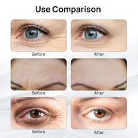 COWANIEE 6 Pcs Hyaluronic Microneedle Patches,Anti Wrinkle Patches for Puffy Eyes Bags Under Eyes