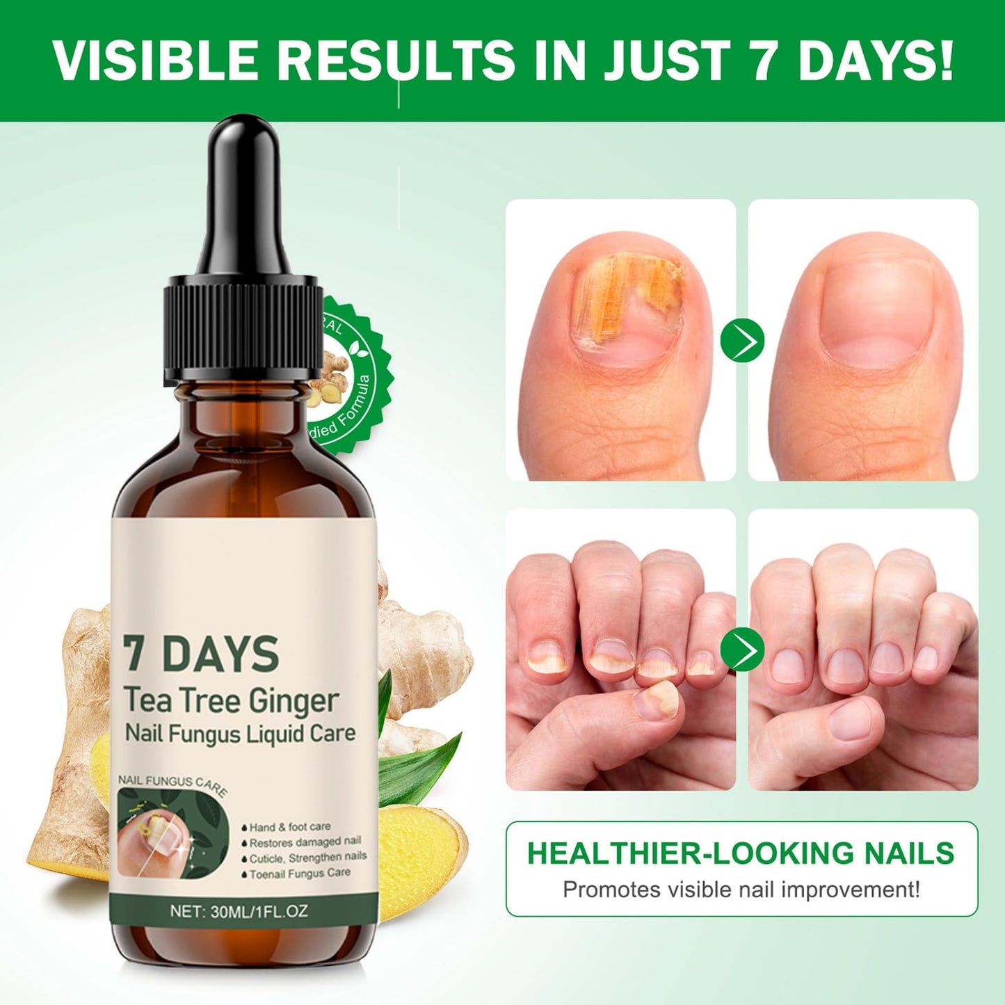 Tea Tree and Ginger Nail Fungus Treatment, Tea Tree Oil for Nail Fungus, 7 Days Fungal Nail Treatment for Toenail, Cuticle Care Oil, Nail Strengthener for Damaged Nails, Ginger Nail Serum