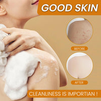 CTUBLIAUNX Kojic Acid Soap, Turmeric Soap Bar for Acne, Dark Spots, Hyperpigmentation, Smooth Skin, Deeply Moisturising with Natural Ingredients, Fit for Face, Body & All Skin Types
