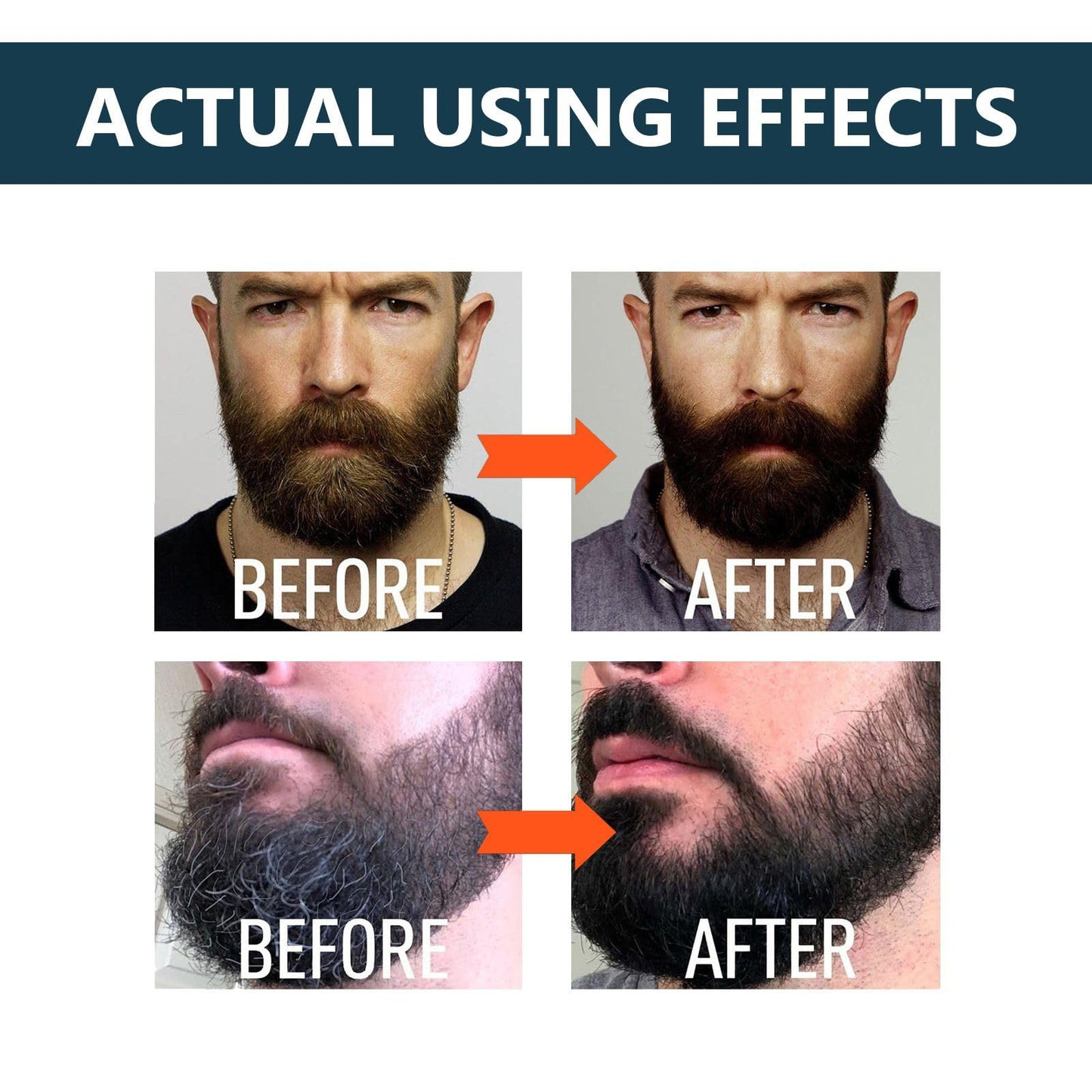 Jinjiar Beard Growth Kit,Beard Growth Oil with Roller for Promote Hair Regrowth,Natural Ingredients Beard Growth Serum,Beard Growth Serum for Men,Acial Hair Treatment,Beard Thickener for Men,Mens Beard Growth