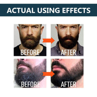 Jinjiar Beard Growth Kit,Beard Growth Oil with Roller for Promote Hair Regrowth,Natural Ingredients Beard Growth Serum,Beard Growth Serum for Men,Acial Hair Treatment,Beard Thickener for Men,Mens Beard Growth