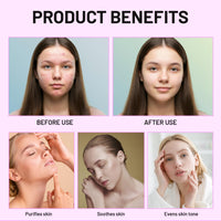 Bettinay Rosacea Cream for Face, 12% Azelaic Acid Cream, Gentle and Moisturizing for all Skin Pigmentation Redness