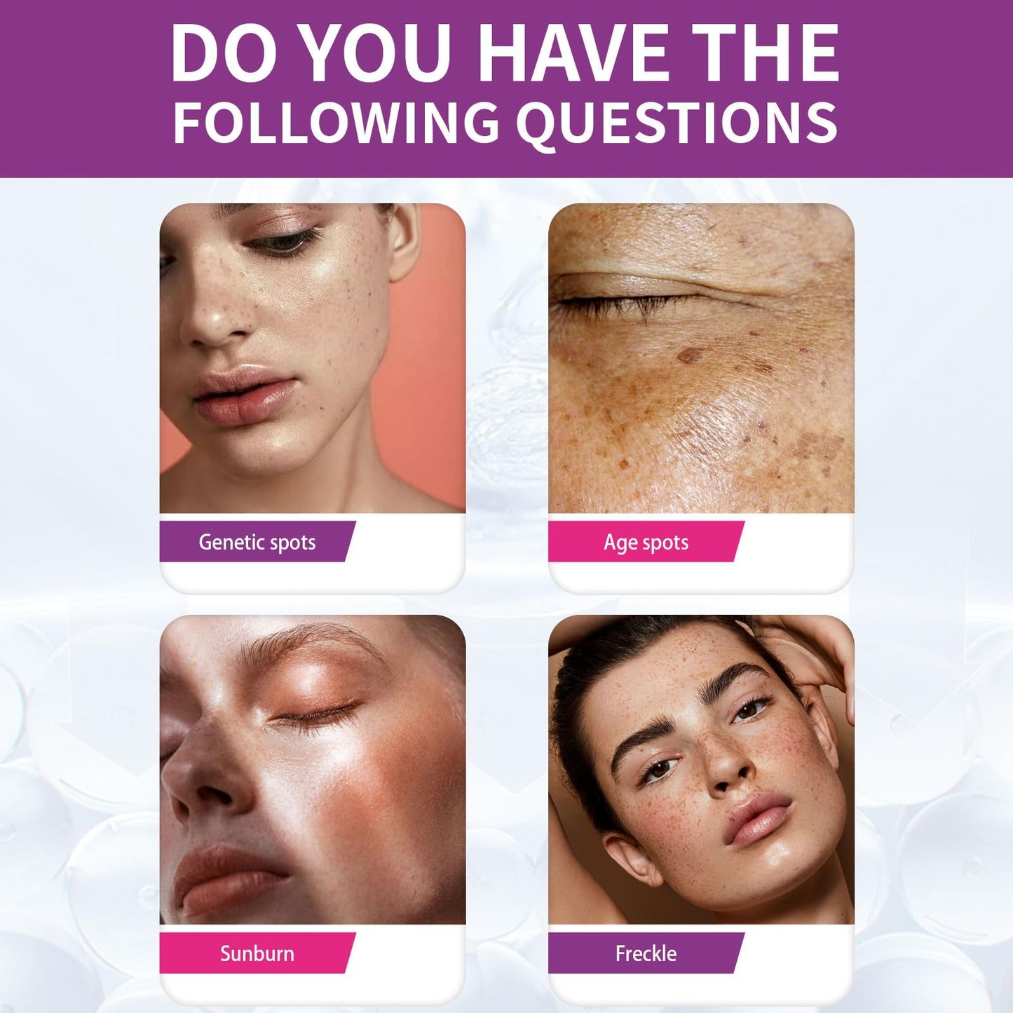 Whitening Anti-Wrinkle Cream,Firming Anti Aging Face Cream,Pigmentation Removal Cream,Dark Spot Remover for Face,Freckle Remove Anti Wrinkle F-ace Crea-m,Whitening Fa-ce Cre-am for All Skin Type