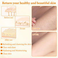 KDJXZ Turmeric Soap 2 Pieces Tumeric Soap Acne Dark Spot Smooth Skin, Turmeric Soap Bar, Turmeric Handmade Soap Bar Suitable for Moisturizing Restoring Elasticity Luster and Tightening Pores