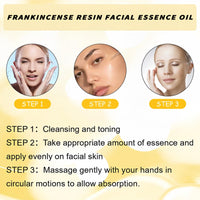 Frankincense Resin Oil for Face,Frankincense Essential Oil,Cold Pressed Serum Anti-Aging & Wrinkle,Frankincense Oil for Skin Organic,Facial Oil,Natural Frankincense Oil for Skin Care,Serum Face
